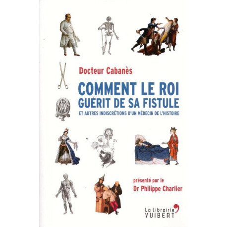 Comment le Roi guérit de sa fistule